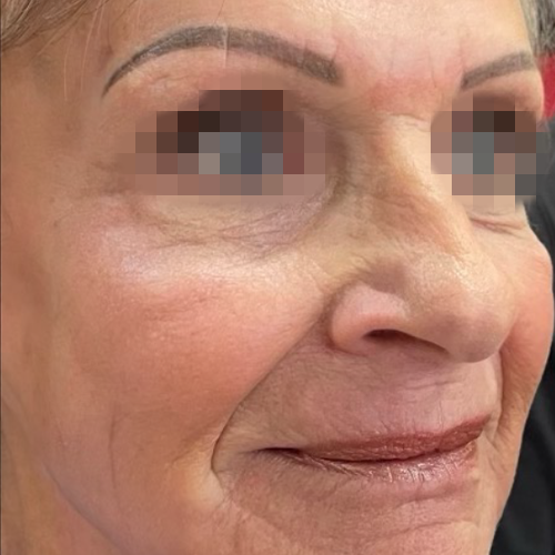 eco2-fine-fittings-med-spa-a-1_