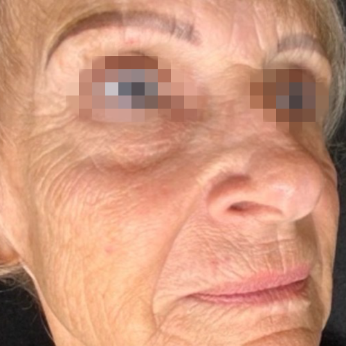 eco2-fine-fittings-med-spa-b-1_